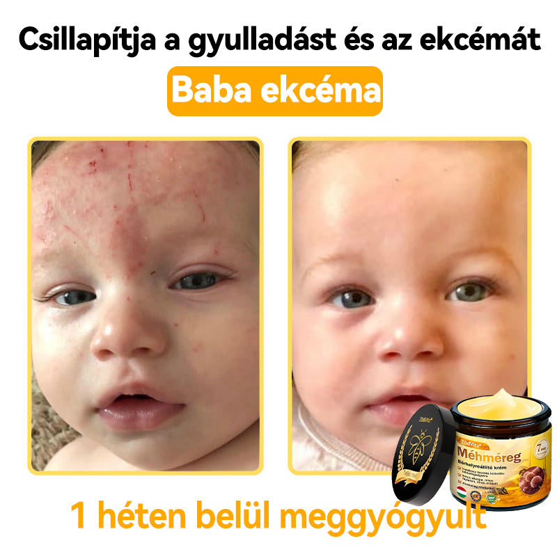 💧💧Bőrgyógyász ajánlása💪ZödVita® Méhméreg Bőrhelyreállító Krém (👨‍⚕‍CE jóváhagyott)👍✅