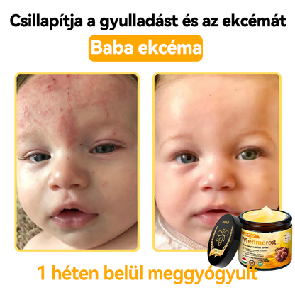 💧💧Bőrgyógyász ajánlása💪ZödVita® Méhméreg Bőrhelyreállító Krém (👨‍⚕‍CE jóváhagyott)👍✅