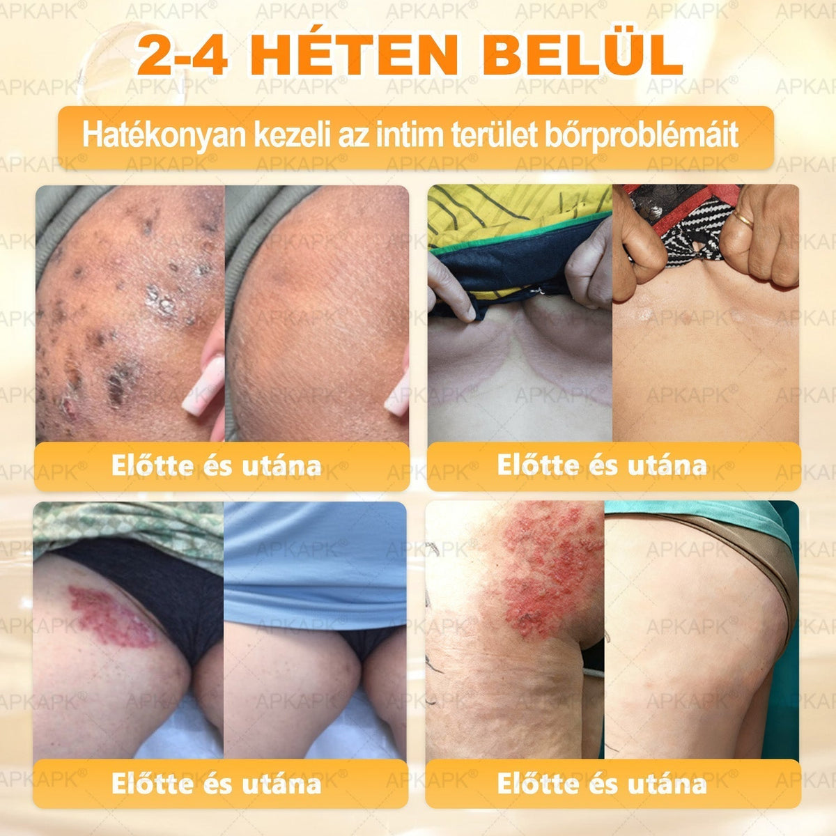 🐝🐝🐝 𝖠𝖯𝖪𝖠𝖯𝖪® Méhméreg Bőr Helyreállító Krém 🔥 Magyar fejlesztés, magyarországi gyártás és szállítás