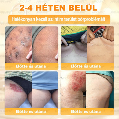 🐝🐝🐝 𝖠𝖯𝖪𝖠𝖯𝖪® Méhméreg Bőr Helyreállító Krém 🔥 Magyar fejlesztés, magyarországi gyártás és szállítás