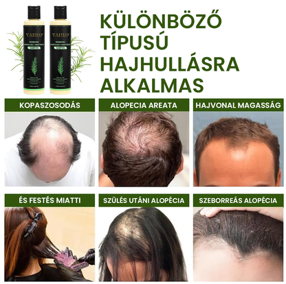 🔥 𝗨𝗧𝗢𝗟𝗦Ó 𝗡𝗔𝗣 – 𝟱𝟬% 𝗞𝗘𝗗𝗩𝗘𝗭𝗠É𝗡𝗬! 🎅 𝗬𝗔𝗜𝗜𝗘𝗢® 𝗕𝗶𝗼 𝗥𝗼𝘇𝗺𝗮𝗿𝗶𝗻𝗼𝘀 𝗛𝗮𝗷𝗻ö𝘃𝗲𝗸𝗲𝗱é𝘀𝘁 𝗦𝗲𝗿𝗸𝗲𝗻𝘁ő 𝗦𝗮𝗺𝗽𝗼𝗻 & 𝗛𝗮𝗷𝗯𝗮𝗹𝘇𝘀𝗮𝗺