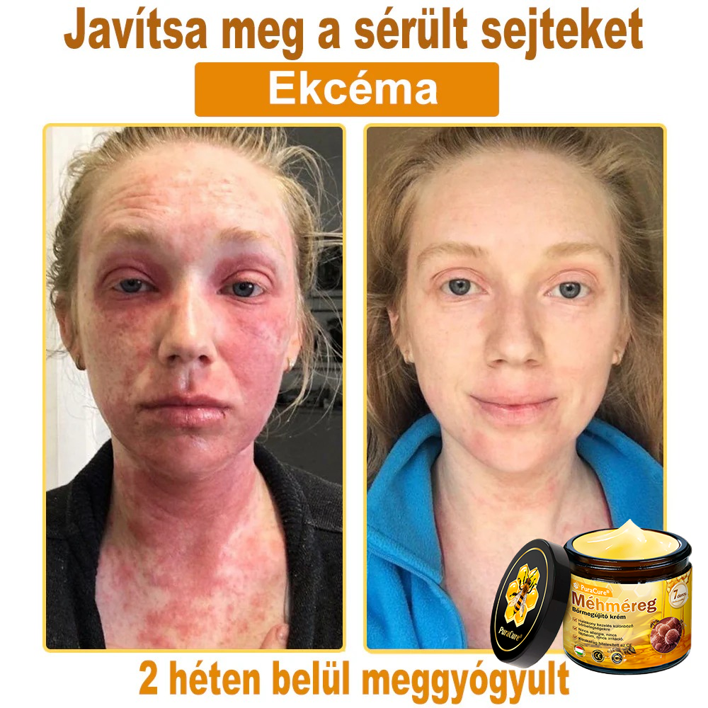 🌿𝐏𝐮𝐫𝐚𝐂𝐮𝐫𝐞® 𝐌é𝐡𝐦é𝐫𝐞𝐠 𝐁ő𝐫 𝐇𝐞𝐥𝐲𝐫𝐞á𝐥𝐥í𝐭ó 𝐊𝐫é𝐦 (𝐂𝐄 𝐓𝐚𝐧ú𝐬í𝐭𝐯á𝐧𝐲)👍✅