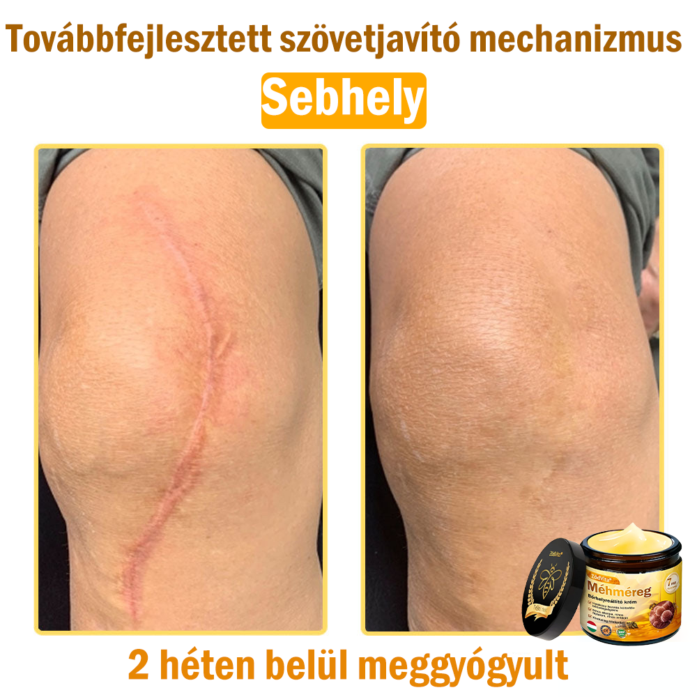 💧💧Bőrgyógyász ajánlása💪ZödVita® Méhméreg Bőrhelyreállító Krém (👨‍⚕‍CE jóváhagyott)👍✅