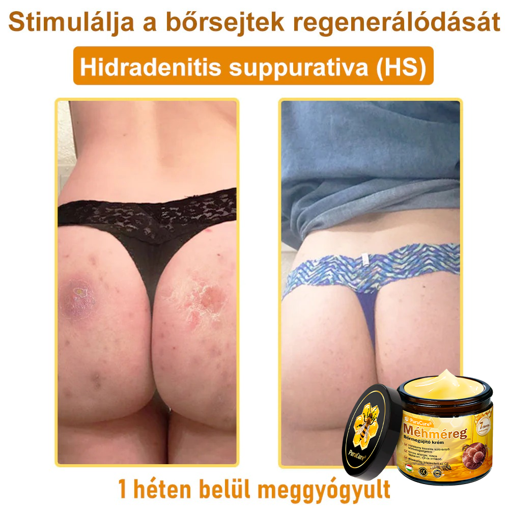 🌿𝐏𝐮𝐫𝐚𝐂𝐮𝐫𝐞® 𝐌é𝐡𝐦é𝐫𝐞𝐠 𝐁ő𝐫 𝐇𝐞𝐥𝐲𝐫𝐞á𝐥𝐥í𝐭ó 𝐊𝐫é𝐦 (𝐂𝐄 𝐓𝐚𝐧ú𝐬í𝐭𝐯á𝐧𝐲)👍✅