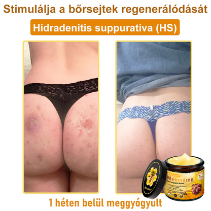 🌿𝐏𝐮𝐫𝐚𝐂𝐮𝐫𝐞® 𝐌é𝐡𝐦é𝐫𝐞𝐠 𝐁ő𝐫 𝐇𝐞𝐥𝐲𝐫𝐞á𝐥𝐥í𝐭ó 𝐊𝐫é𝐦 (𝐂𝐄 𝐓𝐚𝐧ú𝐬í𝐭𝐯á𝐧𝐲)👍✅