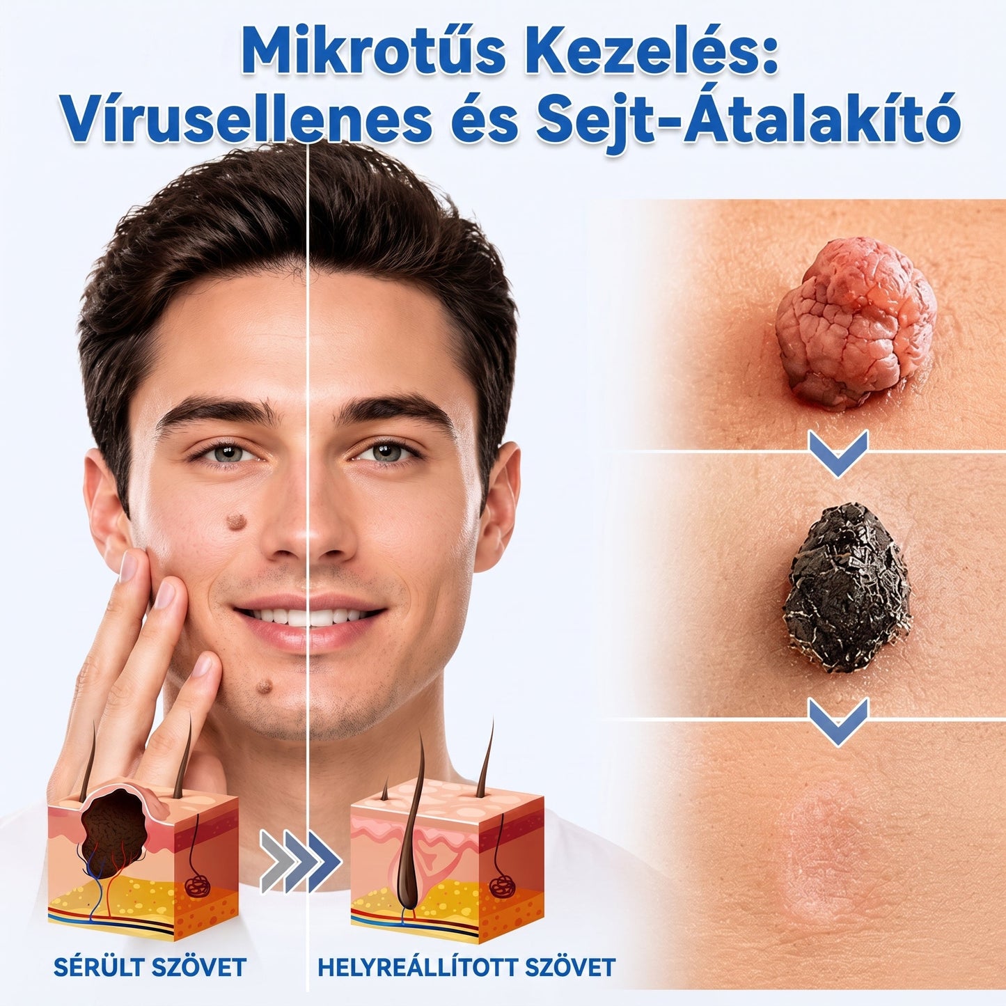 🌿𝐏𝐮𝐫𝐚𝐂𝐮𝐫𝐞® 𝟐 𝐚𝐳 𝟏-𝐛𝐞𝐧 𝐦𝐢𝐤𝐫𝐨𝐭ű𝐬 é𝐬 𝐡𝐢𝐝𝐫𝐨𝐤𝐨𝐥𝐥𝐨𝐢𝐝 𝐭𝐚𝐩𝐚𝐬𝐳🍀 | 𝐊𝐢á𝐥𝐥ó 𝐚𝐧𝐲𝐚𝐣𝐞𝐠𝐲𝐞𝐤, 𝐚𝐤𝐧é𝐤, 𝐥𝐚𝐩𝐨𝐬 𝐬𝐳𝐞𝐦ö𝐥𝐜𝐬ö𝐤 é𝐬 𝐛ő𝐫𝐧ö𝐯𝐞𝐝é𝐤𝐞𝐤 𝐞𝐥𝐭á𝐯𝐨𝐥í𝐭á𝐬á𝐫𝐚 | 𝐒𝐞𝐠í𝐭 𝐜𝐬ö𝐤𝐤𝐞𝐧𝐭𝐞𝐧𝐢 𝐚 𝐫á𝐧𝐜𝐨𝐤𝐚𝐭, 𝐡𝐞𝐠𝐞𝐤𝐞𝐭 é𝐬 𝐛ő𝐫𝐡𝐢𝐛á𝐤𝐚𝐭 | 𝐋á𝐭𝐡𝐚𝐭𝐚𝐭𝐥𝐚𝐧 𝐭𝐚𝐩𝐚𝐬𝐳 𝐚𝐳 𝐚𝐫𝐜𝐫𝐚 é𝐬 𝐭𝐞𝐬𝐭𝐫𝐞