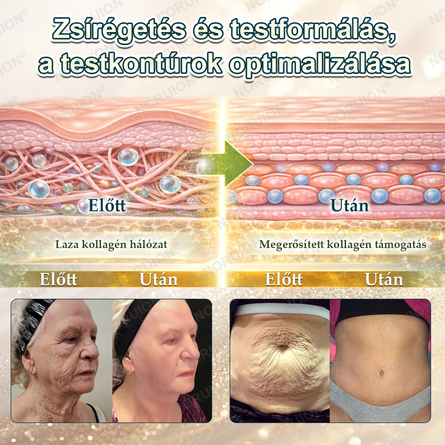 ✨ NORUION® AKG Sejtszintű Metabolikus Aktiváló Szérum 👩‍⚕️