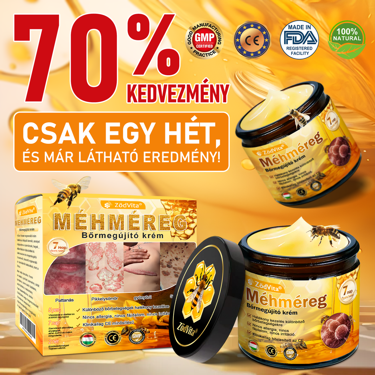 🍃 Bőrgyógyász ajánlása ✨ ZödVita® Méhméreg Bőr Helyreállító Krém 🔥 Magyar fejlesztés, magyarországi gyártás és szállítás