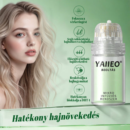 🍎🍎YAIIEO® 𝑭á𝒋𝒅𝒂𝒍𝒐𝒎𝒎𝒆𝒏𝒕𝒆𝒔 𝑴𝒊𝒌𝒓𝒐𝒊𝒏𝒇ú𝒛𝒊ó𝒔 𝑹𝒆𝒏𝒅𝒔𝒛𝒆𝒓 Mélyen ható DHT-blokkolás, hajhagymák újraaktiválása és látható hajnövekedés