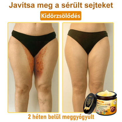 🍀Bőrgyógyász ajánlása 💪 ZödVita® Méhméreg Bőr Helyreállító Krém 🔥 Magyar fejlesztés, magyarországi gyártás és szállítás🌿