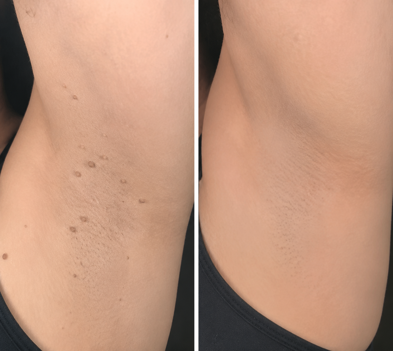 🌿𝐏𝐮𝐫𝐚𝐂𝐮𝐫𝐞® 𝟐 𝐚𝐳 𝟏-𝐛𝐞𝐧 𝐦𝐢𝐤𝐫𝐨𝐭ű𝐬 é𝐬 𝐡𝐢𝐝𝐫𝐨𝐤𝐨𝐥𝐥𝐨𝐢𝐝 𝐭𝐚𝐩𝐚𝐬𝐳🍀 | 𝐊𝐢á𝐥𝐥ó 𝐚𝐧𝐲𝐚𝐣𝐞𝐠𝐲𝐞𝐤, 𝐚𝐤𝐧é𝐤, 𝐥𝐚𝐩𝐨𝐬 𝐬𝐳𝐞𝐦ö𝐥𝐜𝐬ö𝐤 é𝐬 𝐛ő𝐫𝐧ö𝐯𝐞𝐝é𝐤𝐞𝐤 𝐞𝐥𝐭á𝐯𝐨𝐥í𝐭á𝐬á𝐫𝐚 | 𝐒𝐞𝐠í𝐭 𝐜𝐬ö𝐤𝐤𝐞𝐧𝐭𝐞𝐧𝐢 𝐚 𝐫á𝐧𝐜𝐨𝐤𝐚𝐭, 𝐡𝐞𝐠𝐞𝐤𝐞𝐭 é𝐬 𝐛ő𝐫𝐡𝐢𝐛á𝐤𝐚𝐭 | 𝐋á𝐭𝐡𝐚𝐭𝐚𝐭𝐥𝐚𝐧 𝐭𝐚𝐩𝐚𝐬𝐳 𝐚𝐳 𝐚𝐫𝐜𝐫𝐚 é𝐬 𝐭𝐞𝐬𝐭𝐫𝐞