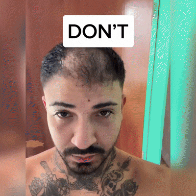 🍎🍎YAIIEO® 𝑭á𝒋𝒅𝒂𝒍𝒐𝒎𝒎𝒆𝒏𝒕𝒆𝒔 𝑴𝒊𝒌𝒓𝒐𝒊𝒏𝒇ú𝒛𝒊ó𝒔 𝑹𝒆𝒏𝒅𝒔𝒛𝒆𝒓 Mélyen ható DHT-blokkolás, hajhagymák újraaktiválása és látható hajnövekedés