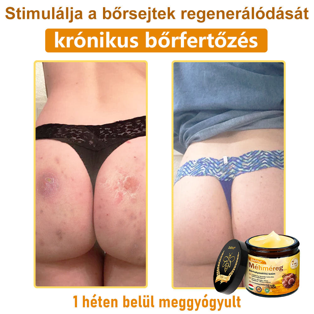 🍀Bőrgyógyász ajánlása 💪 ZödVita® Méhméreg Bőr Helyreállító Krém 🔥 Magyar fejlesztés, magyarországi gyártás és szállítás🌿