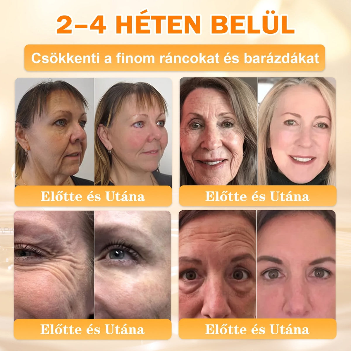 🐝🐝🐝 𝖠𝖯𝖪𝖠𝖯𝖪® Méhméreg Bőr Helyreállító Krém 🔥 Magyar fejlesztés, magyarországi gyártás és szállítás