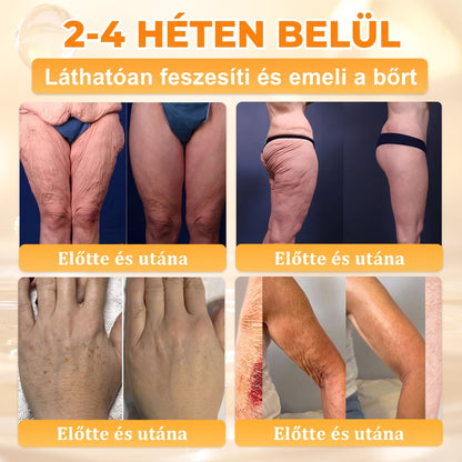 🐝🐝🐝 𝖠𝖯𝖪𝖠𝖯𝖪® Méhméreg Bőr Helyreállító Krém 🔥 Magyar fejlesztés, magyarországi gyártás és szállítás